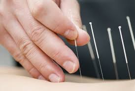 Peut-on mourir de l'acupuncture?